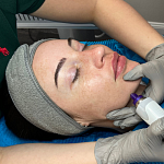 Die effektive und schonende Behandlung für eine Hautreinigung: die Aquafacial Behandlung